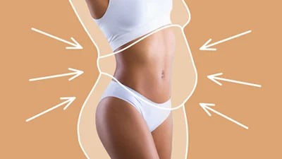 Liposuction